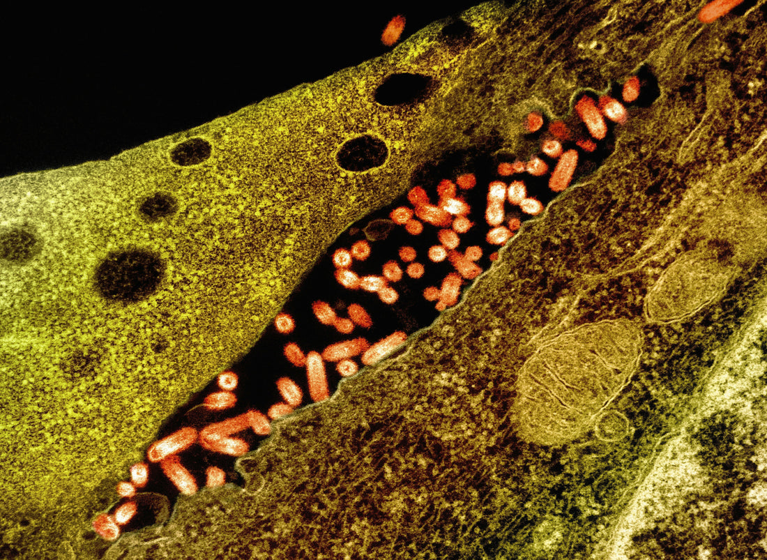 Comprehensive Guide: Fighting Biofilms with Foods, Nutraceuticals, Supplements, Herbs, and Protocols